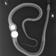 Illustration for article titled X-Ray Of A Snake Who Mistook Golf Balls For Delicious Chicken Eggs